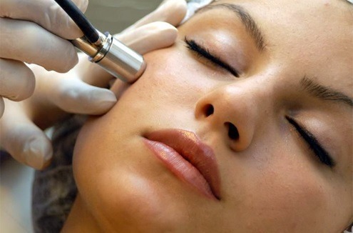 How to Remove Peach Fuzz from Face