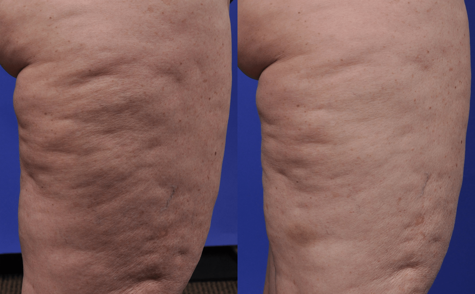 Skin info