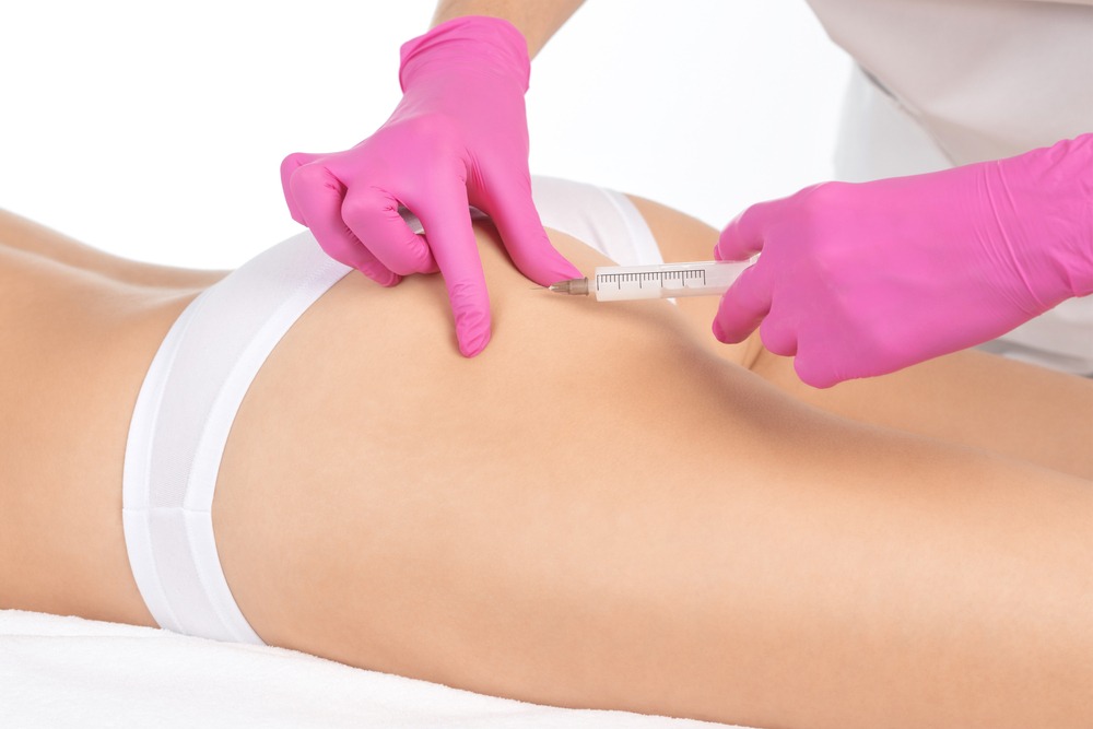 From Flat to Fabulous: Elevate Your Curves with Sculptra Butt Lift