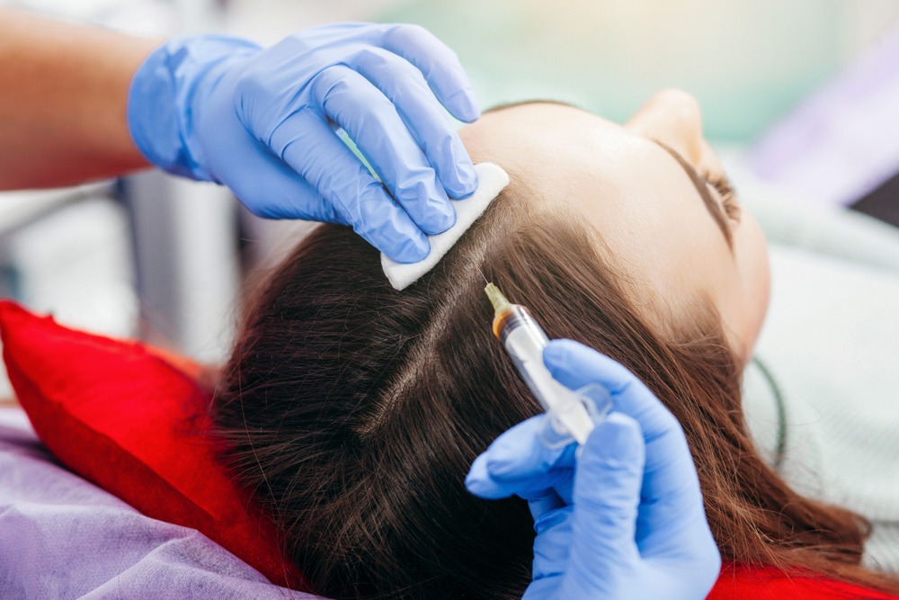 A healthcare professional performs a hair restoration treatment by injecting a serum into the scalp of a patient, who is lying on a padded surface. The procedure aims to promote hair growth and improve scalp health.