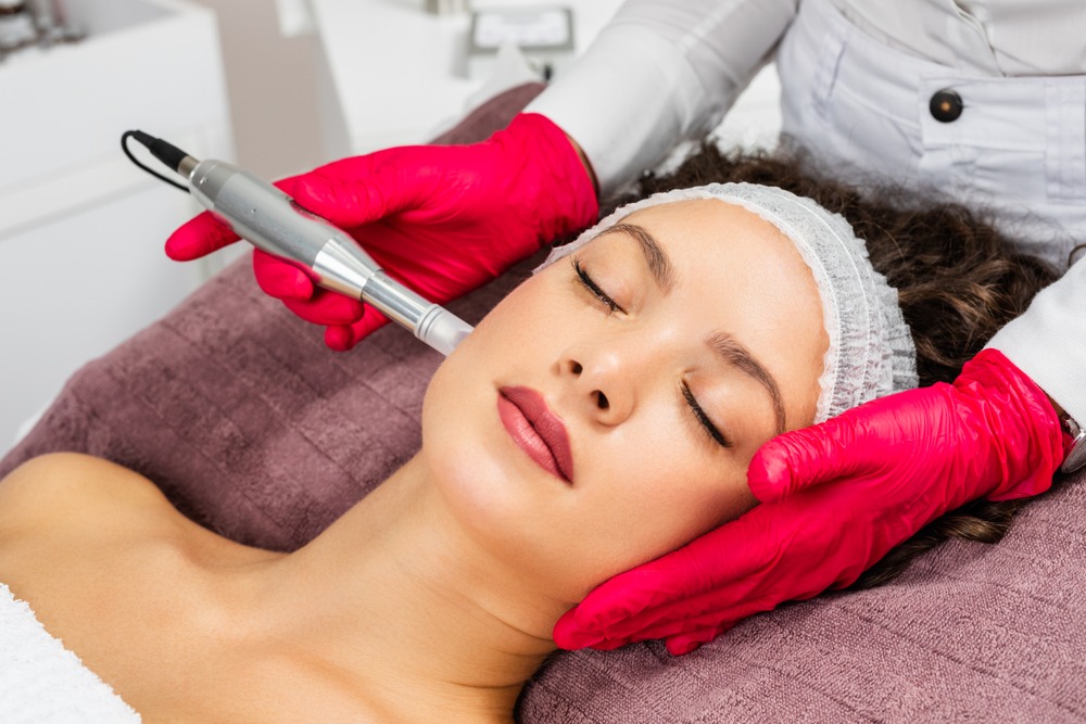 How Do I Get the Best Results from Microneedling?