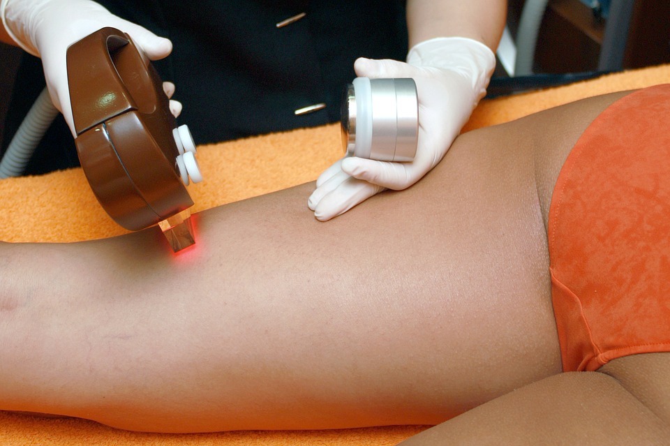 How Long Does Laser Hair Removal Take To Work?