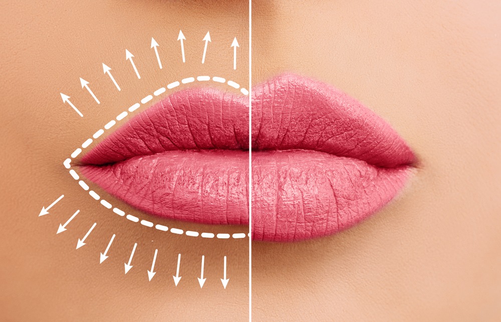 Close-up of pink lips with a smooth finish, showcasing beauty and makeup techniques, highlighted by arrows indicating lip contouring and enhancement methods.