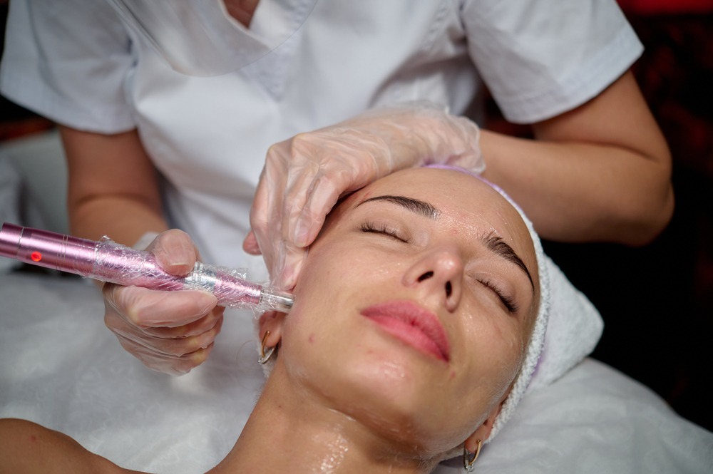 Woman receiving a microneedling facial treatment with a handheld device, while a technician supports her head, highlighting skincare and beauty therapy.