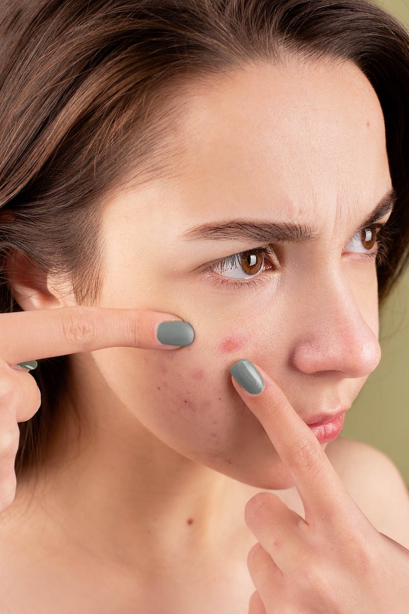 Young woman examining acne on her face, pointing at a blemish while displaying a concerned expression, with a neutral background.