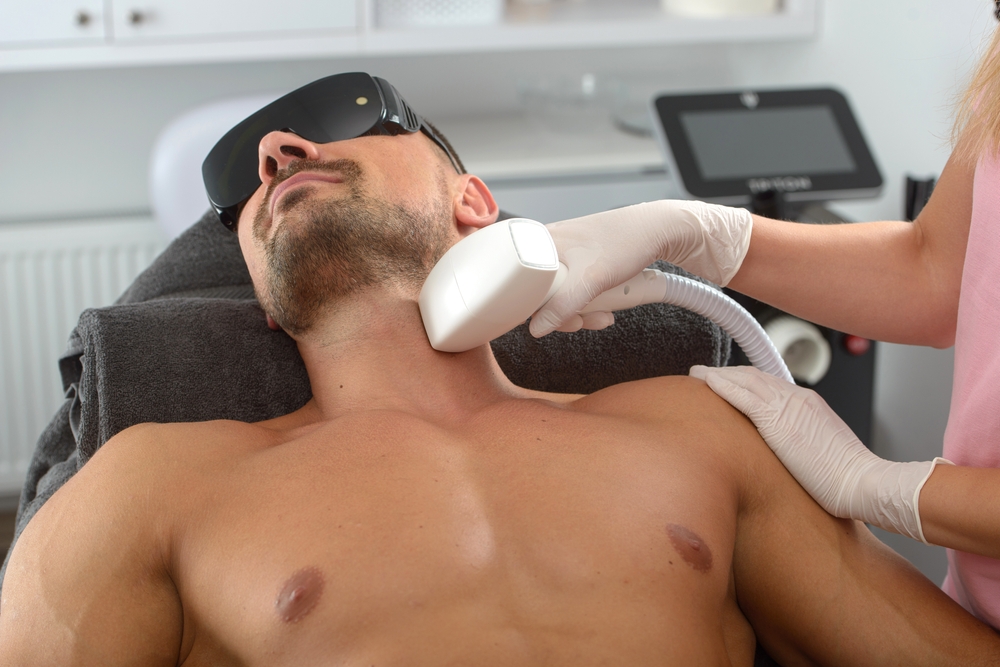 Is Laser Hair Removal for Men Effective?