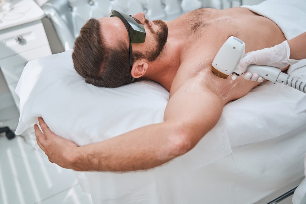 Most Popular Areas for Laser Hair Removal for Men