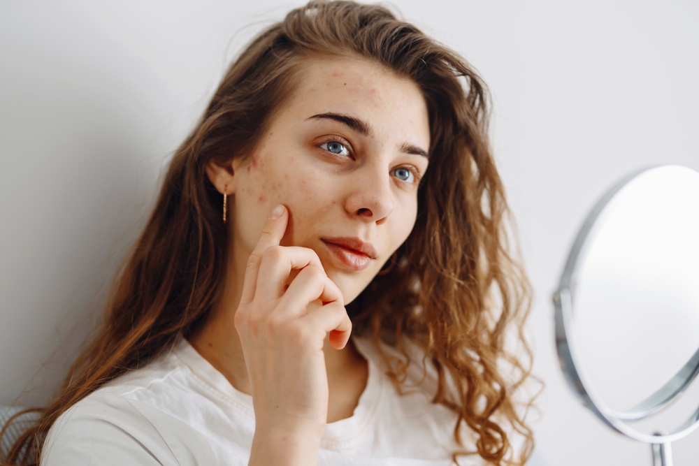 What Is a Blemish?